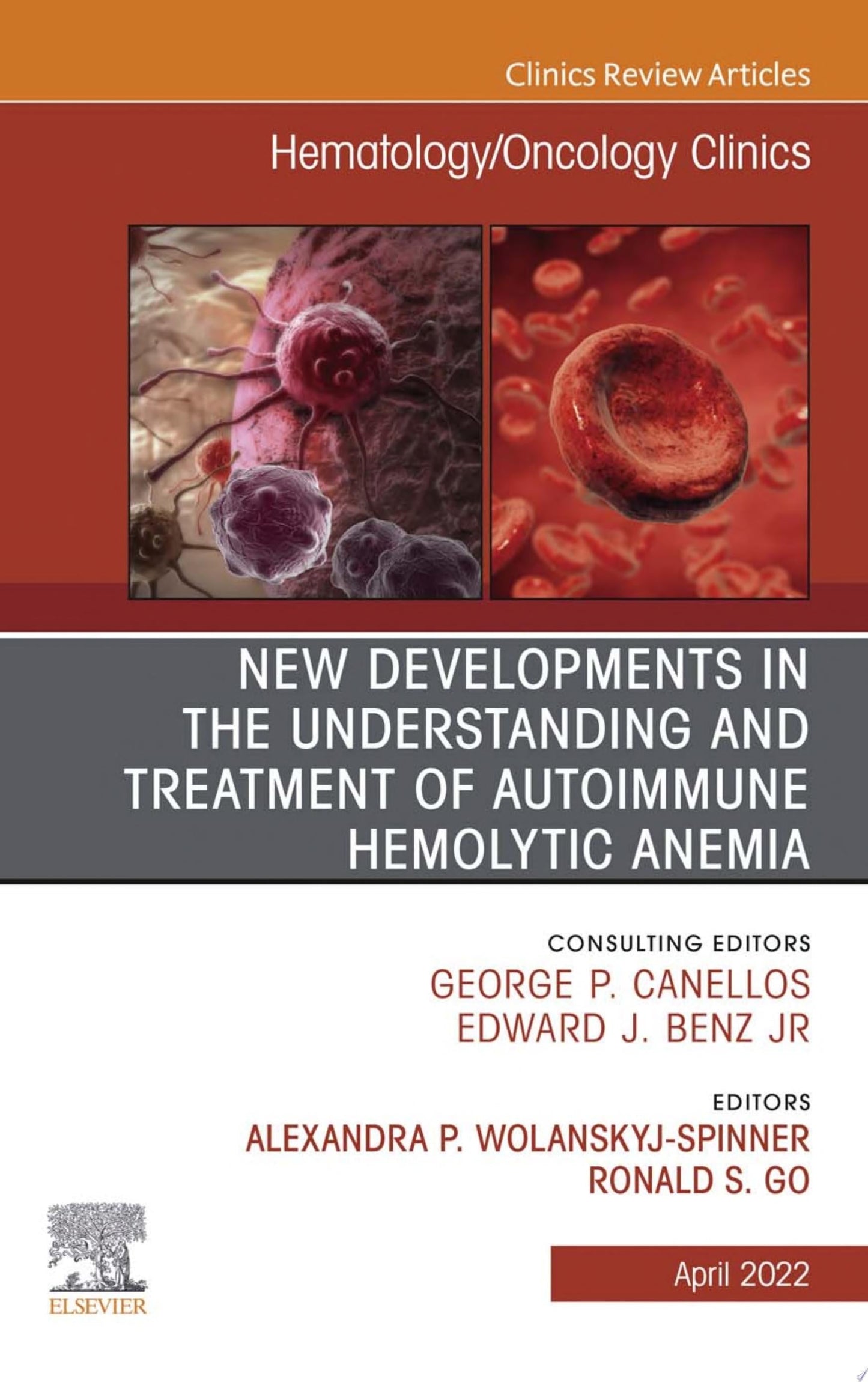 New Developments in the Understanding and Treatment of Autoimmune Hemolytic Anemia, An Issue of Hematology/Oncology Clinics of North America, E-Book