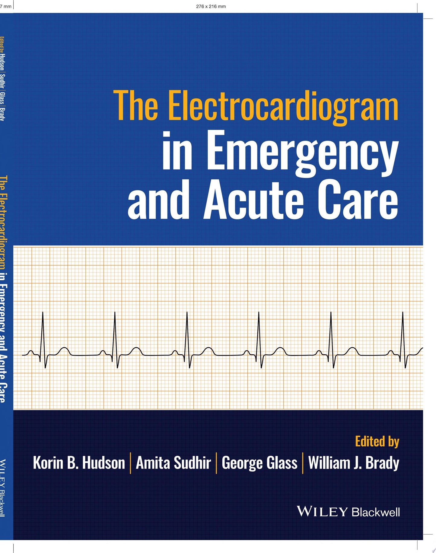 The Electrocardiogram in Emergency and Acute Care