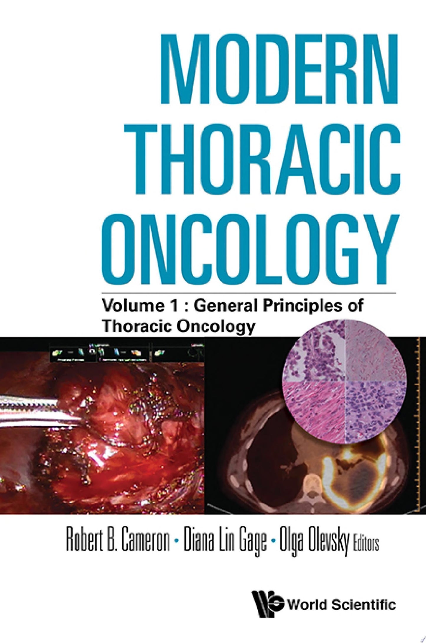 Modern Thoracic Oncology