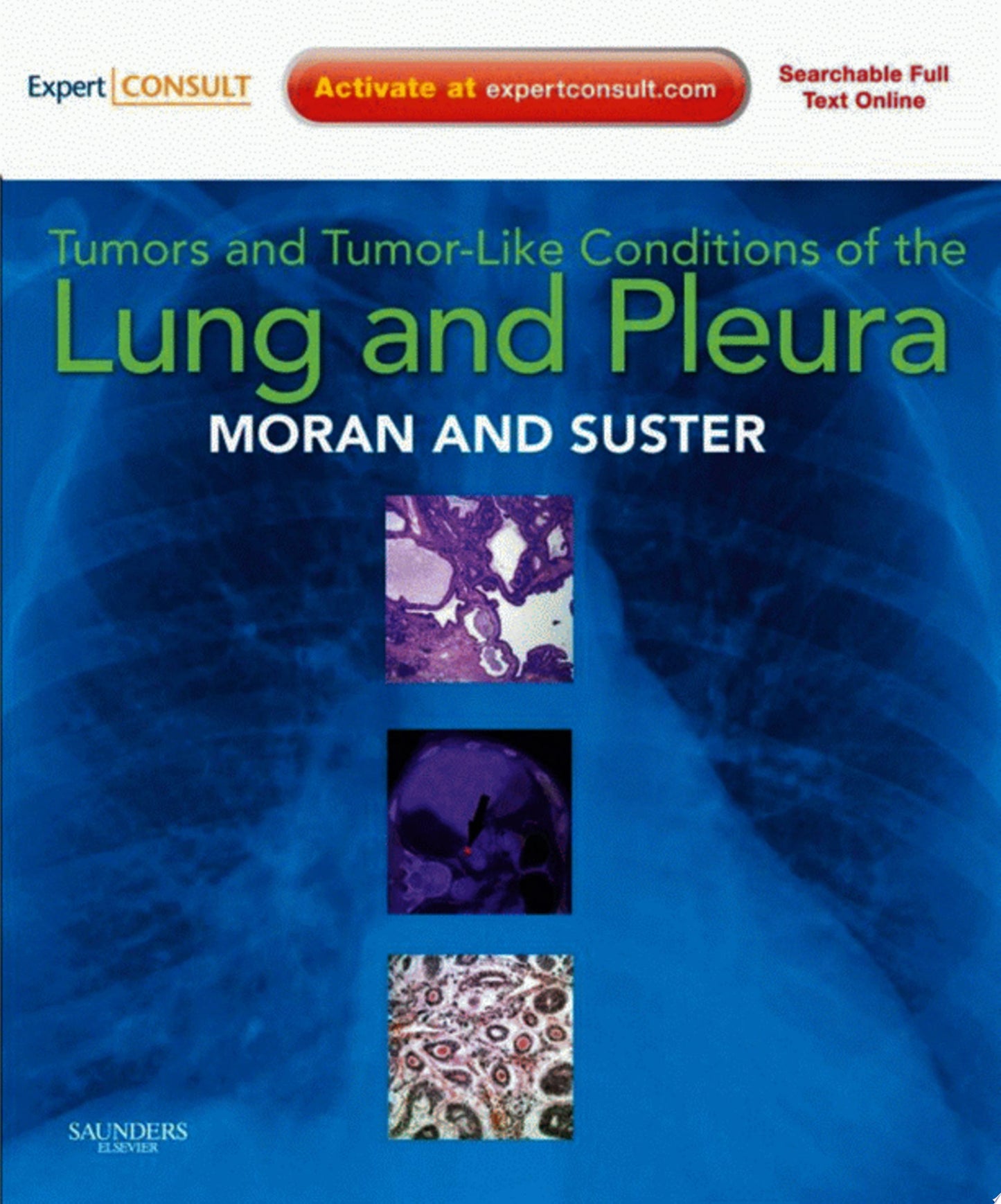 Tumors and Tumor-Like Conditions of the Lung and Pleura