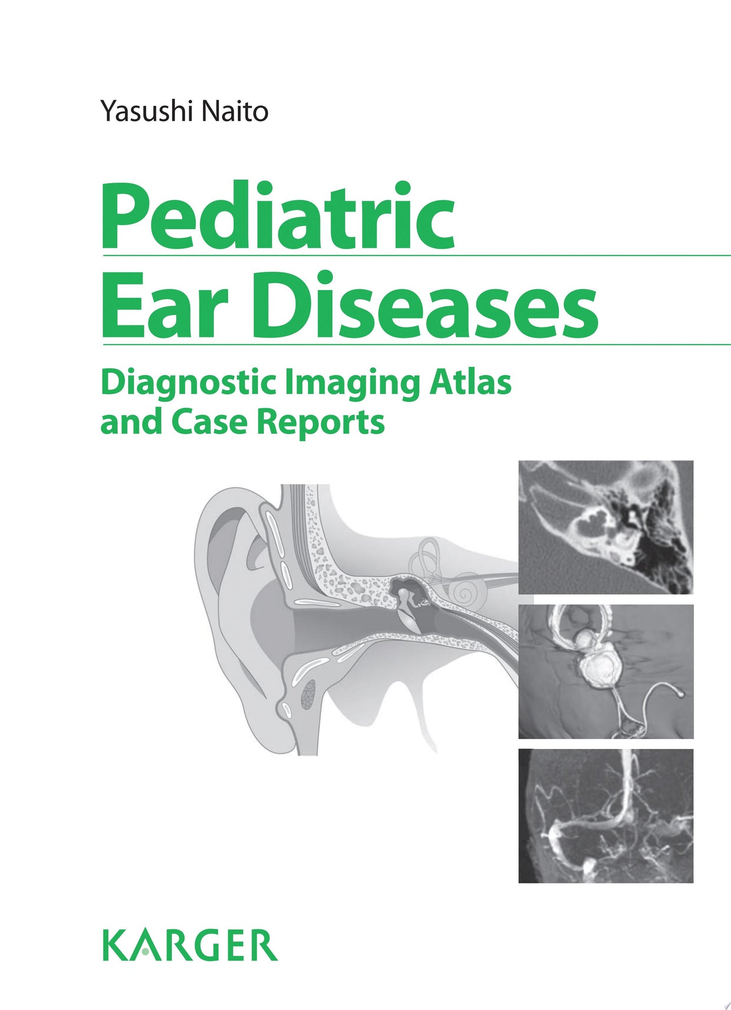 Pediatric Ear Diseases