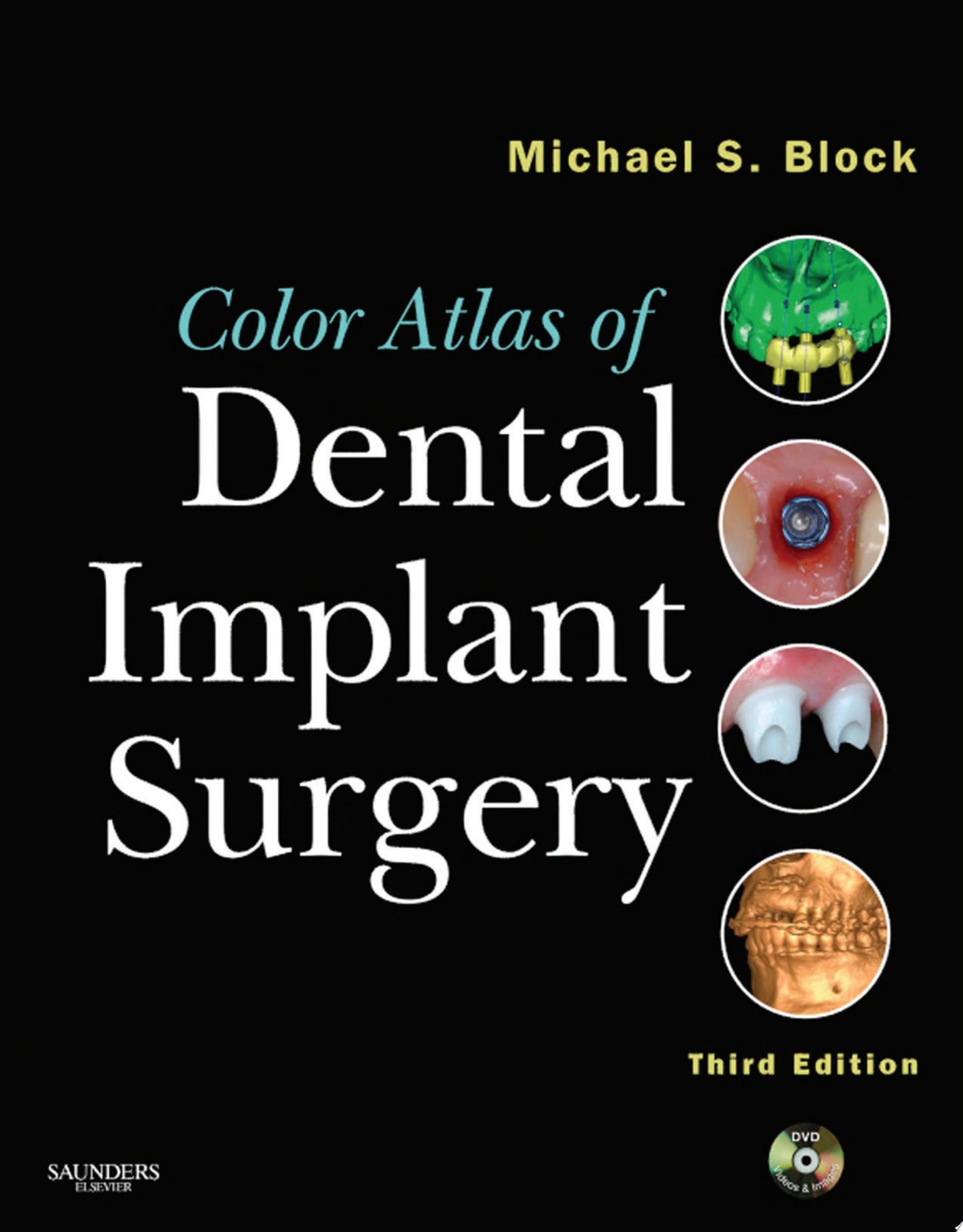 Color Atlas of Dental Implant Surgery - E-Book