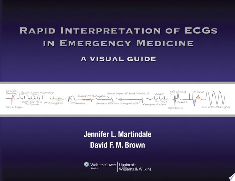 Rapid Interpretation of ECGs in Emergency Medicine: A Visual Guide