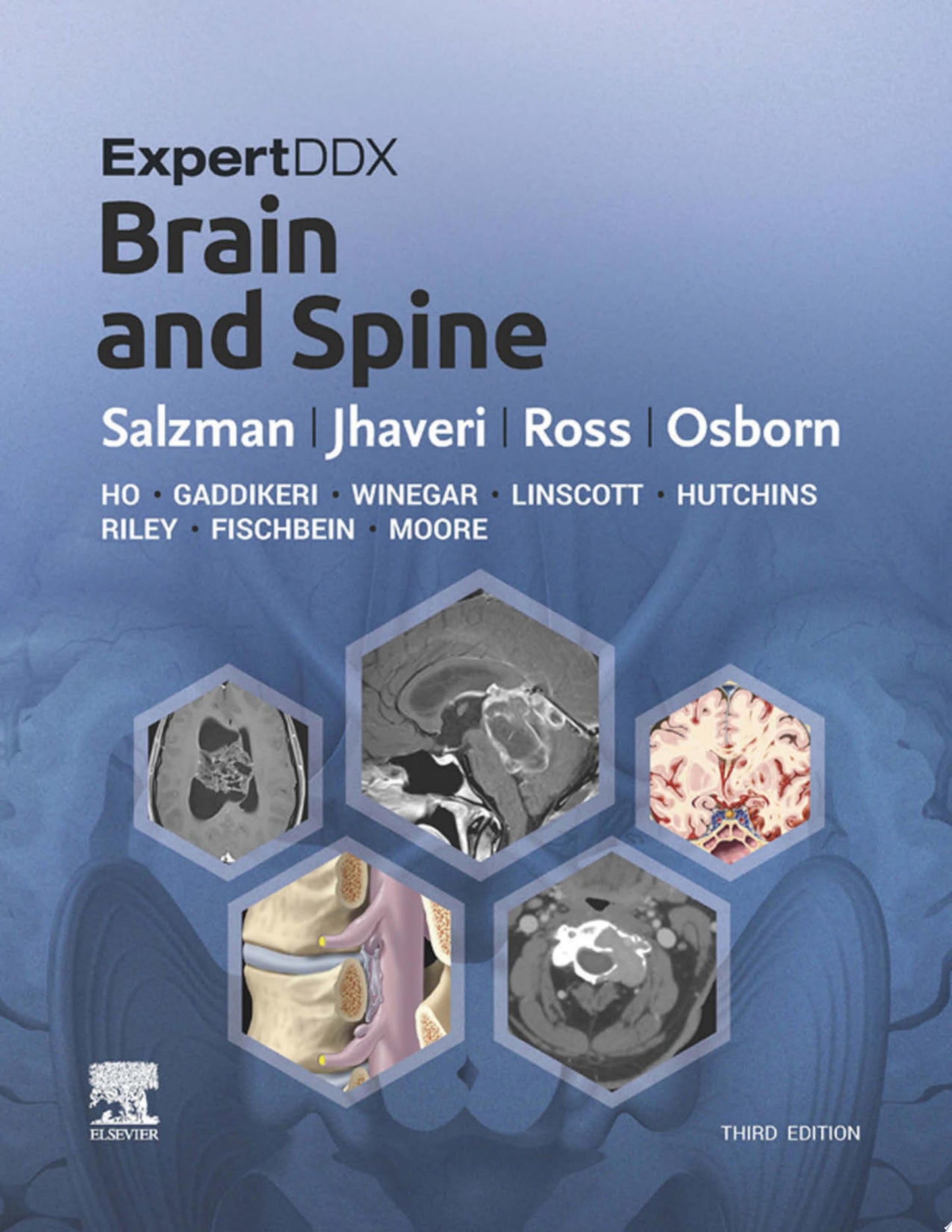 ExpertDDx: Brain and Spine, 2nd Edition (ORIGINAL PDF from Publisher)