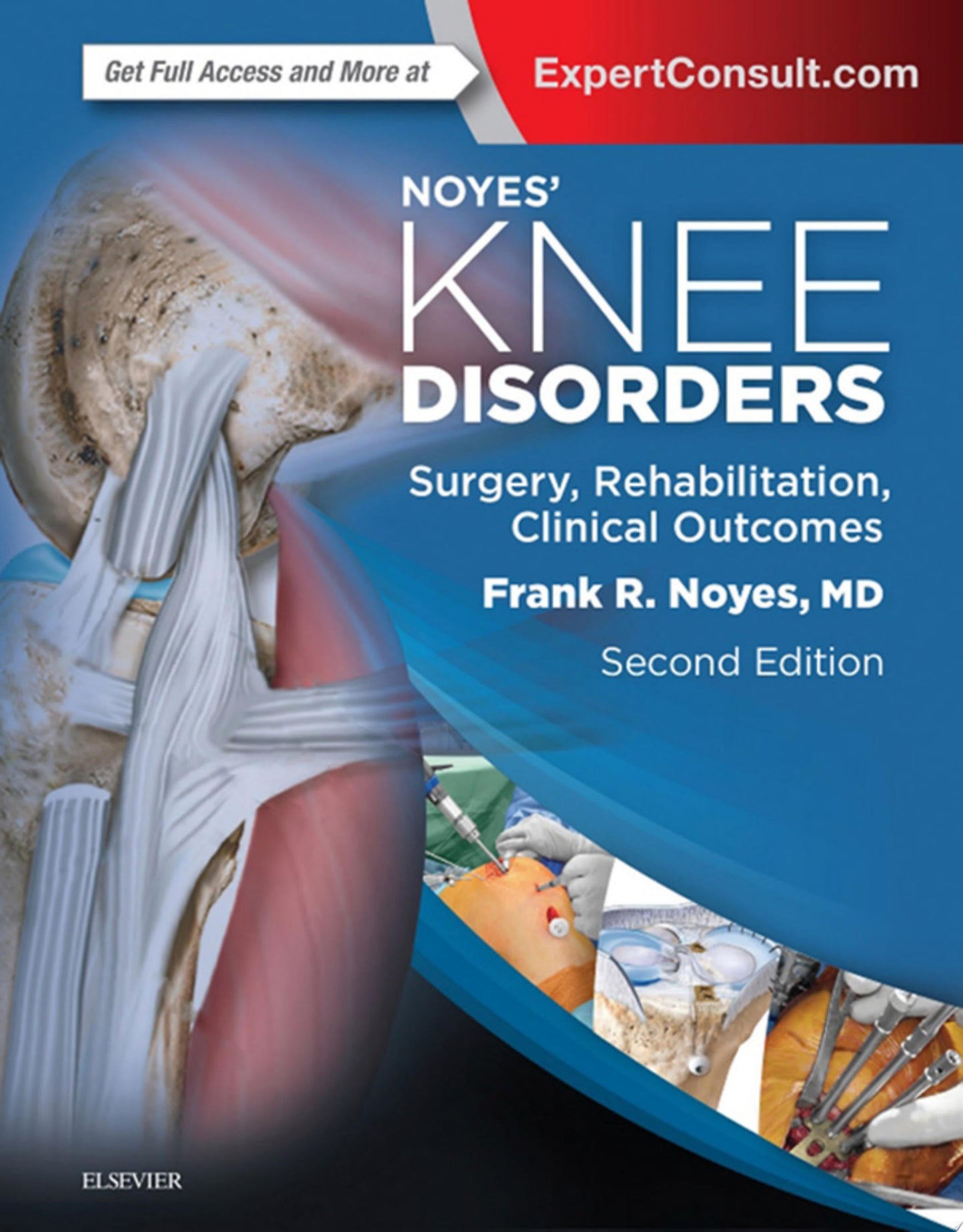 Noyes’ Knee Disorders: Surgery, Rehabilitation, Clinical Outcomes