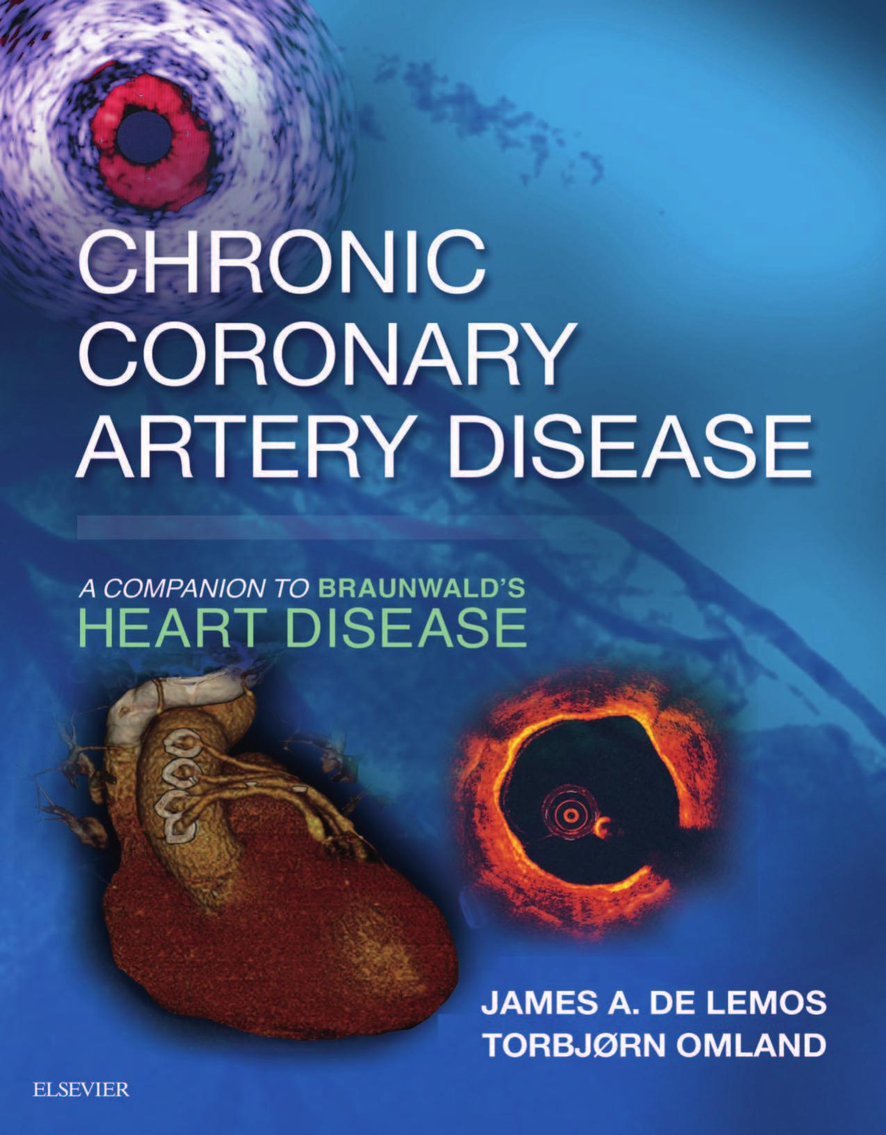 Chronic Coronary Artery Disease: A Companion to Braunwald’s Heart Disease E-Book 1st Edition