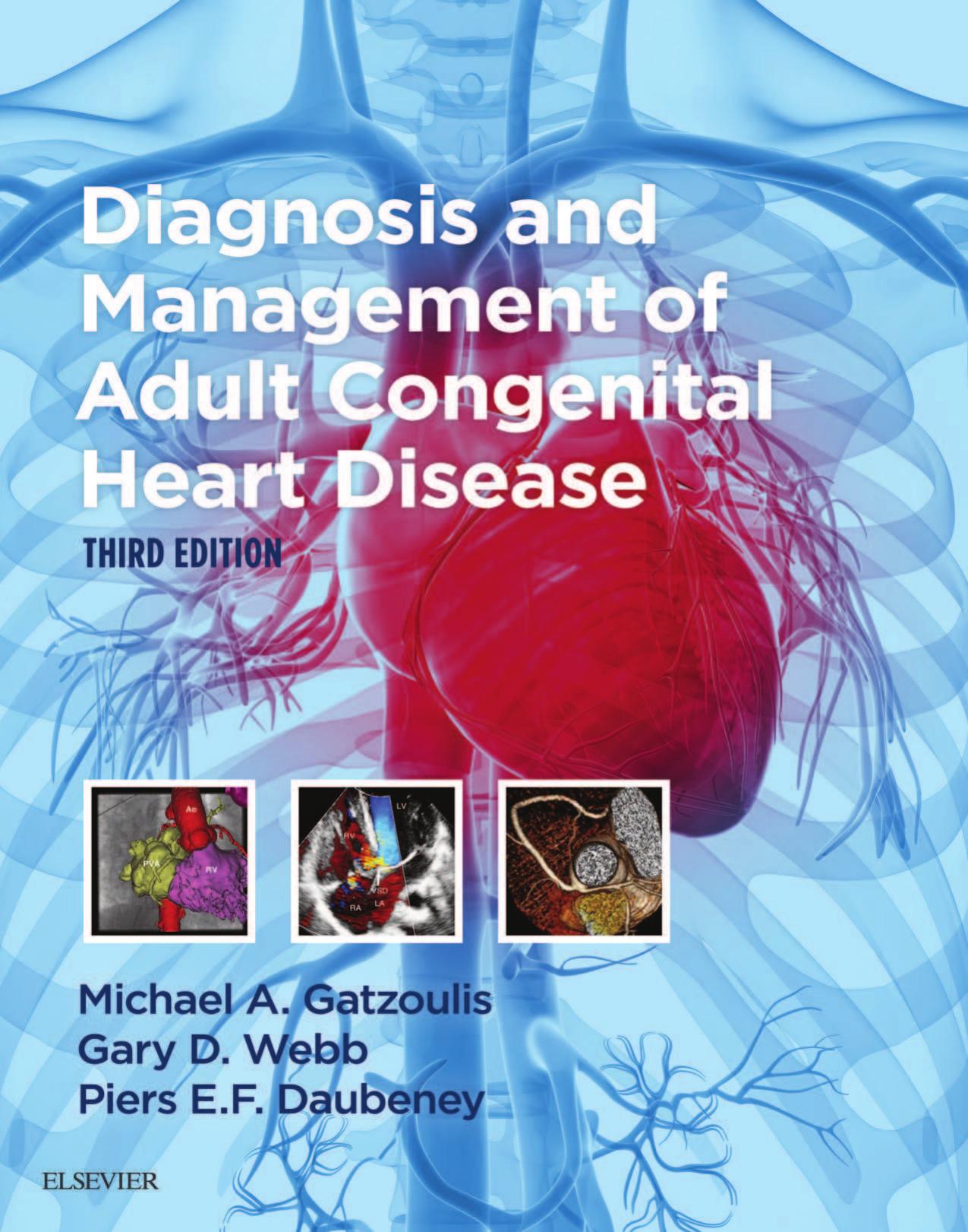 Diagnosis and Management of Adult Congenital Heart Disease, 3rd Edition
